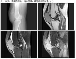 2013年高級(jí)衛(wèi)生專業(yè)技術(shù)資格考試放射醫(yī)學(xué)強(qiáng)化練習(xí)題及答案解析（1月30日·放射衛(wèi)生技術(shù)服務(wù)專題）